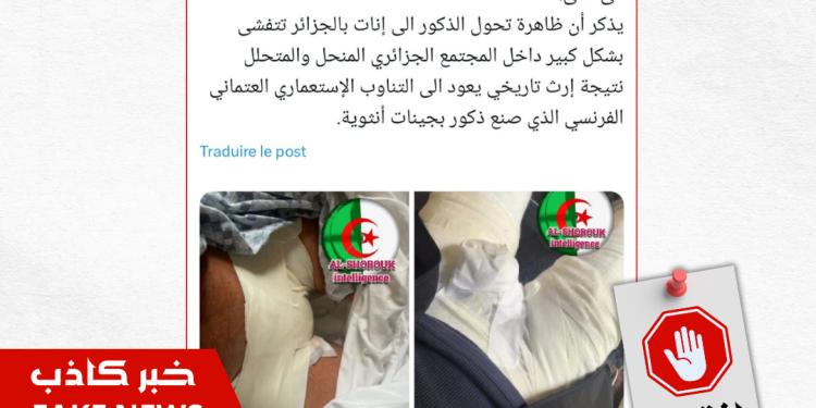 خبر كاذب.. لا وجود للتحول الجنسي في الجزائر
